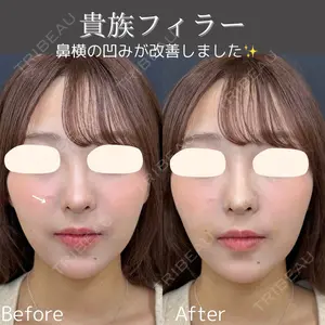 症例