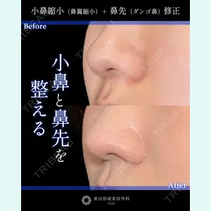 症例