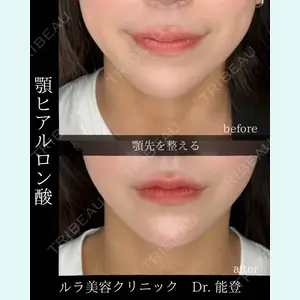 ルラ美容クリニック 札幌院 能登 貴弘医師の症例