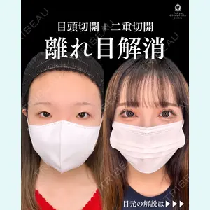 症例