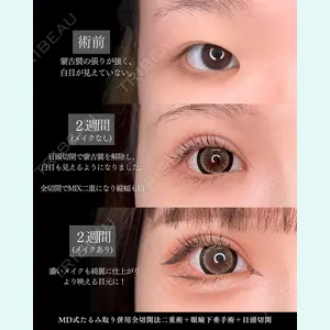 症例