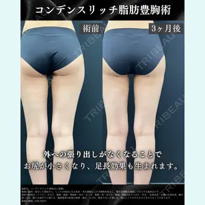 湘南美容クリニック Regno 銀座院 大谷 悠輔医師の症例
