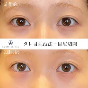 LOUIS CLINIC 二子玉川院【ルイクリニック】 小松 塁医師の症例