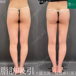 症例