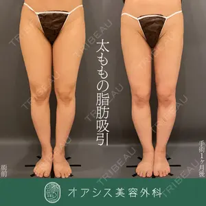 症例