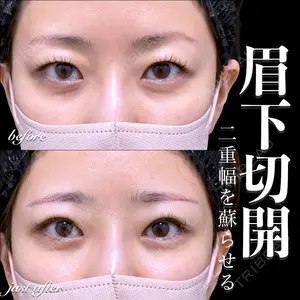 EMMO FACE CLINIC 大宮院 百瀬 直也医師の症例