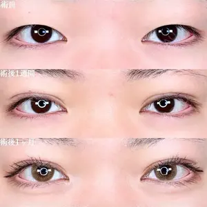 症例
