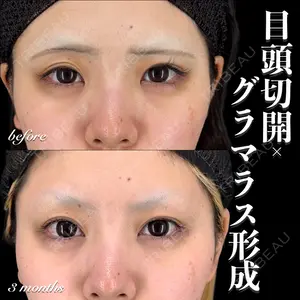 EMMO FACE CLINIC 大宮院 百瀬 直也医師の症例