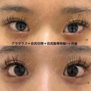 エターナル美容クリニック 久門田 詳医師の症例