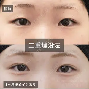 コスメディカルクリニック シンシア 銀座院 梁 淑姫医師の症例