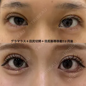エターナル美容クリニックの症例