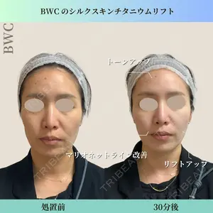 ビューティー和心クリニック 浅草院の症例