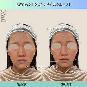 ビューティー和心クリニック 浅草院の症例