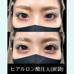 HAAB×DREAM BEAUTY CLINIC 東京本院 佐野 圭医師の症例