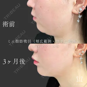 ziz CLINIC 村岡 史子医師の症例