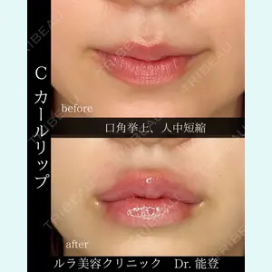 ルラ美容クリニック 札幌院 能登 貴弘医師の症例