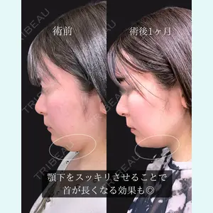 東京シンデレラ美容外科 池袋院 石井 達也医師の症例