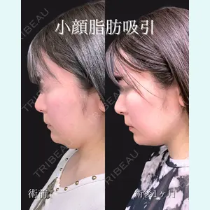 東京シンデレラ美容外科 池袋院 石井 達也医師の症例