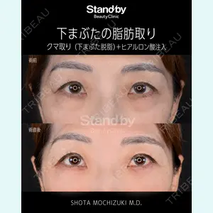 Stand by Beauty Clinic 望月 聖太医師の症例