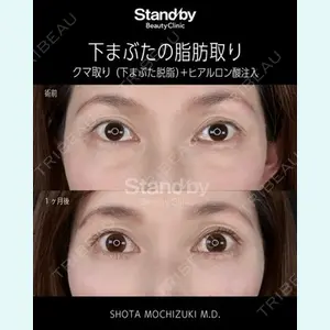 Stand by Beauty Clinic 望月 聖太医師の症例
