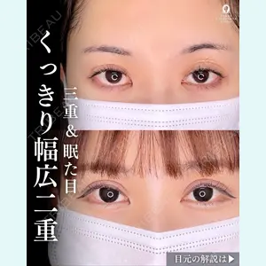 症例