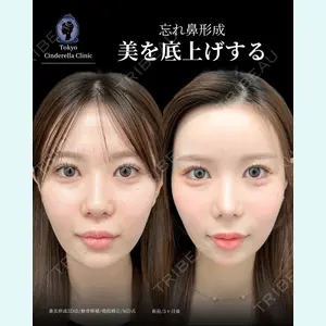 症例