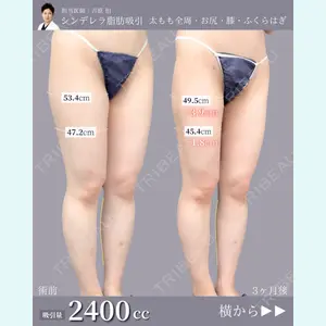 症例