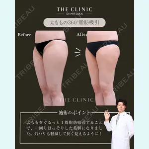 症例