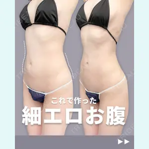 症例