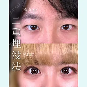東京シンデレラ美容外科 池袋院 石井 達也医師の症例