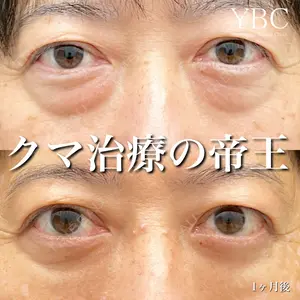 YBC横浜美容外科 大宮院 磯村 亮輔医師の症例