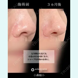 東京形成美容外科 船橋院 弓削田　浩主医師の症例