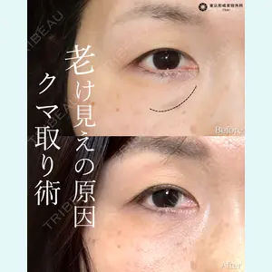 東京形成美容外科 船橋院 山崎 修吾医師の症例