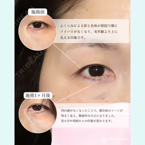 東京形成美容外科 船橋院 山崎 修吾医師の症例