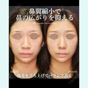 シンデレラ＆ダヴィンチクリニック 宮田 洋佑医師の症例