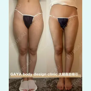 GAYA body design clinicの症例
