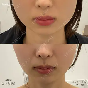 DMTC美容皮膚科 日本橋院 山中大介医師の症例
