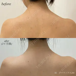 DMTC美容皮膚科 日本橋院の症例