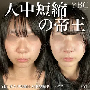 症例