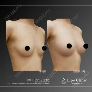 Lipo Clinic omotesando 福田 越医師の症例