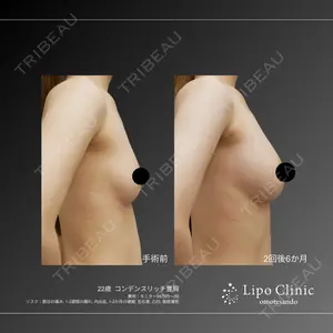 Lipo Clinic omotesando 福田 越医師の症例