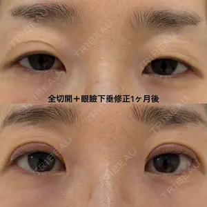 エターナル美容クリニック 久門田 詳医師の症例