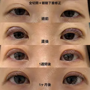 エターナル美容クリニック 久門田 詳医師の症例