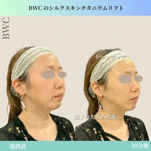ビューティー和心クリニック 浅草院の症例