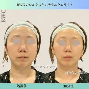 ビューティー和心クリニック 浅草院の症例