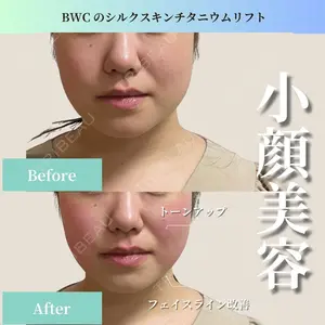 ビューティー和心クリニック 浅草院の症例
