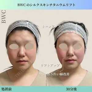 ビューティー和心クリニック 浅草院の症例
