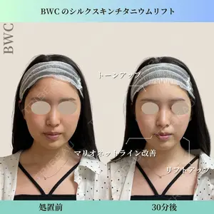 ビューティー和心クリニック 浅草院の症例