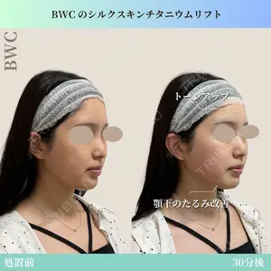 ビューティー和心クリニック 浅草院の症例