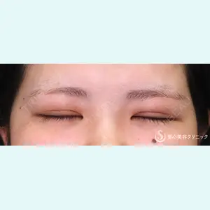 聖心美容クリニック 福岡院 美原 寿之医師の症例